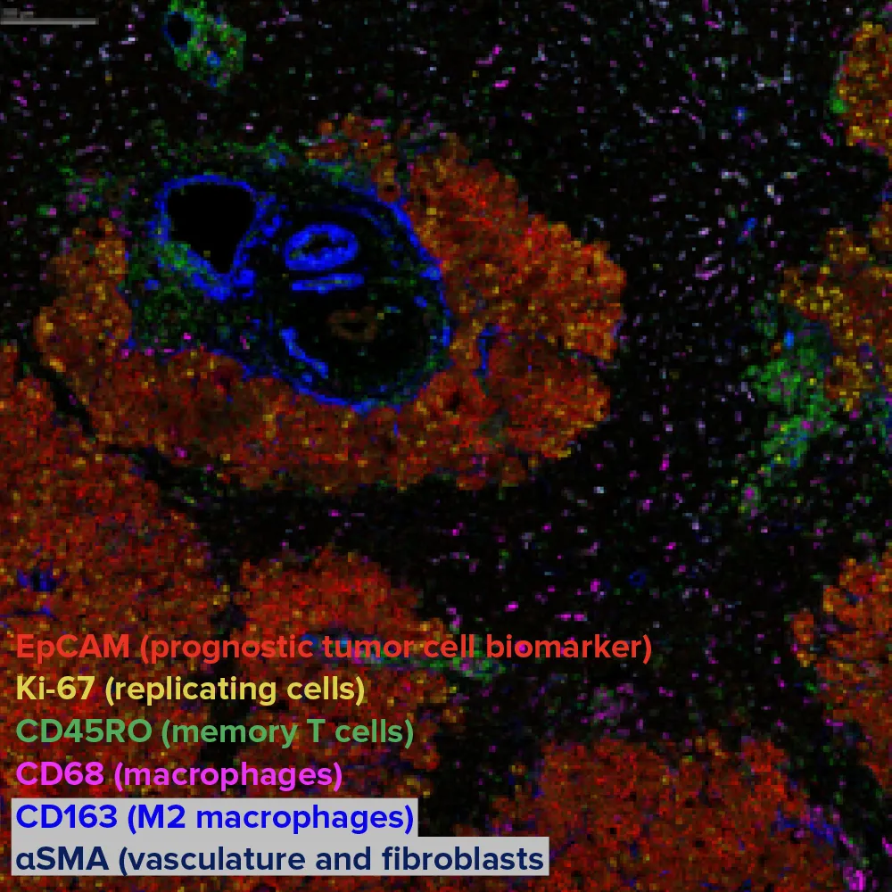 EpCAM