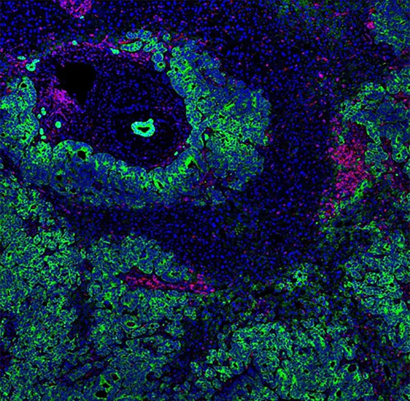 Spatial Multi-Omics