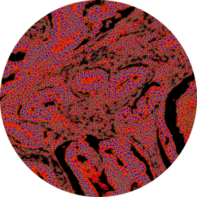IMC cell segmentation ESCH Epimods IMC cell segmentation ESCH Epimods