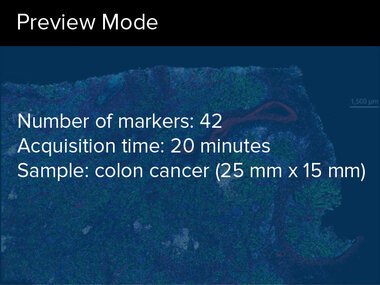 Preview Mode | Number of markers: 42, Acquisition time: 20 minutes, Sample: colon cancer (25 mm x 15 mm)