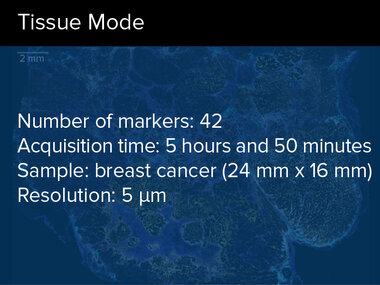 Tissue Mode | Number of markers: 42, Acquisition time: 5 hours and 50 minutes, Sample: breast cancer (24 mm x 16 mm, Resolution: 5 μm
