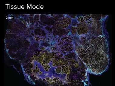 Tissue Mode | Number of markers: 42, Acquisition time: 5 hours and 50 minutes, Sample: breast cancer (24 mm x 16 mm, Resolution: 5 μm