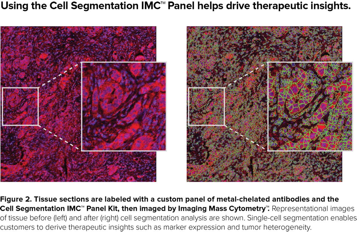 Effective cell segmentation is important to generating quantitative results and more accurate data analysis from IMC experiments. The Therapeutic Insights Services team has developed a novel multimarker panel that helps generate single-cell segmentation for better analysis that can drive more insights