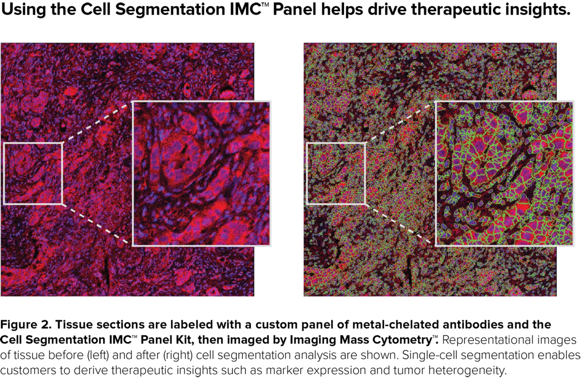 Effective cell segmentation is important to generating quantitative results and more accurate data analysis from IMC experiments. The Therapeutic Insights Services team has developed a novel multimarker panel that helps generate single-cell segmentation for better analysis that can drive more insights Effective cell segmentation is important to generating quantitative results and more accurate data analysis from IMC experiments. The Therapeutic Insights Services team has developed a novel multimarker panel that helps generate single-cell segmentation for better analysis that can drive more insights